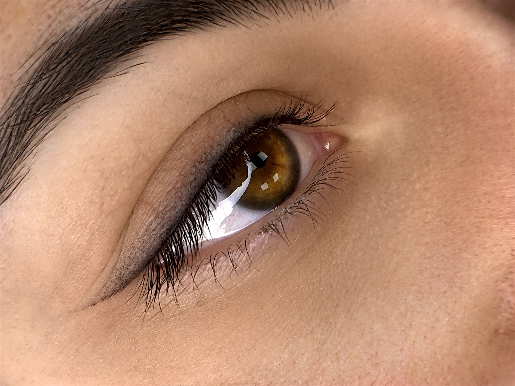 Eyeliner infracigliare — guarigione completa